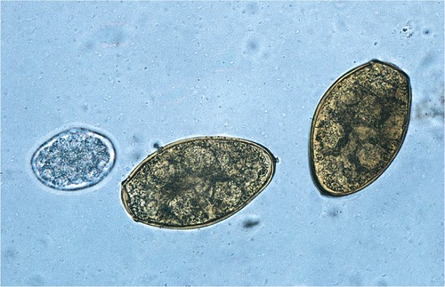 <p>Host: Canines & Felines</p><p>1st I. Host = operculated snail, 2nd I. Host = crayfish</p>