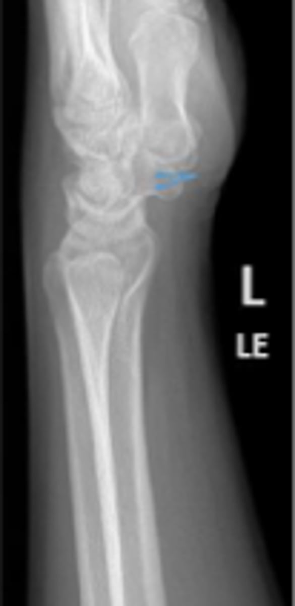 <p>What is the arrow pointing to?</p>