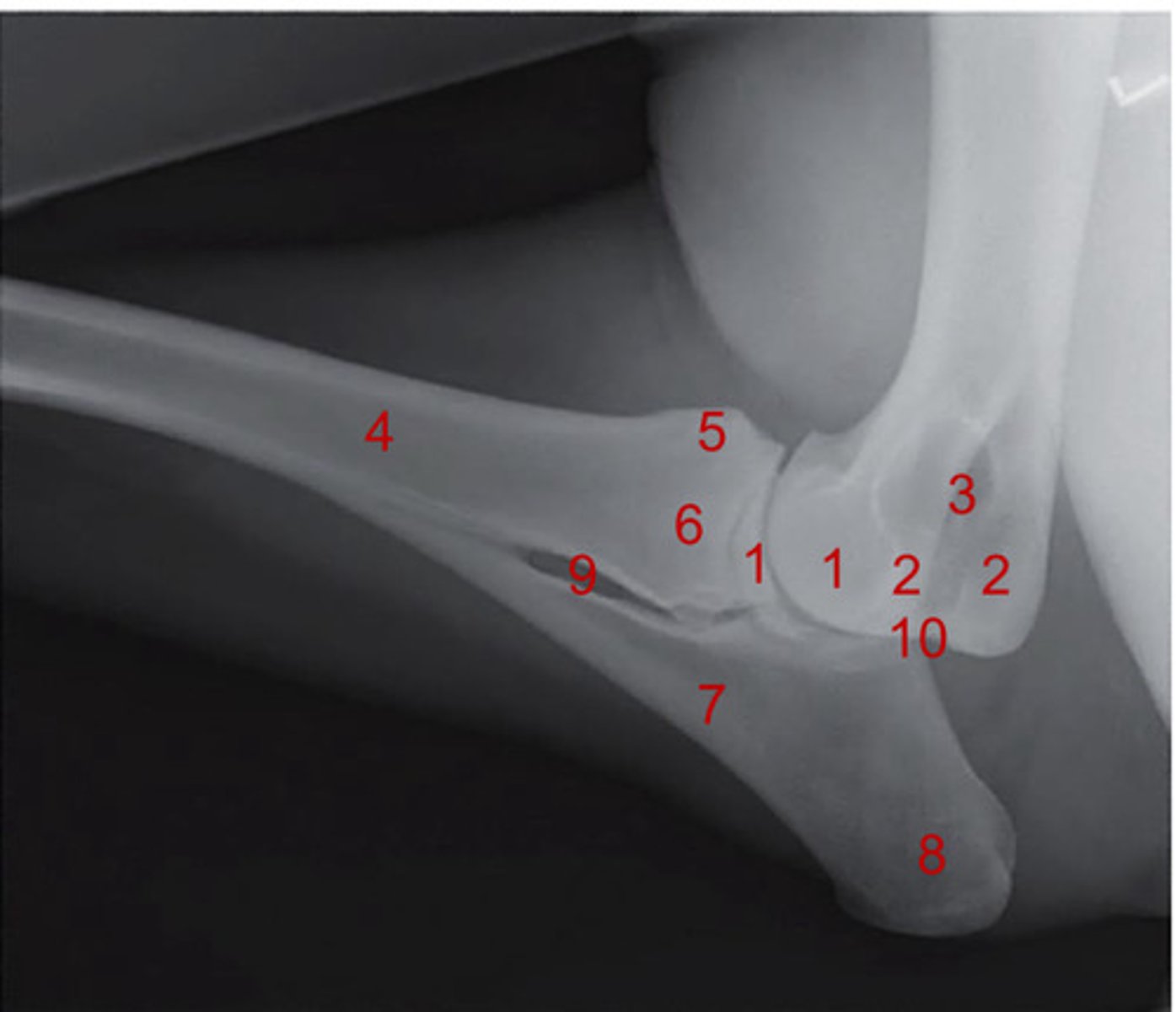 <p>What is 5?</p>