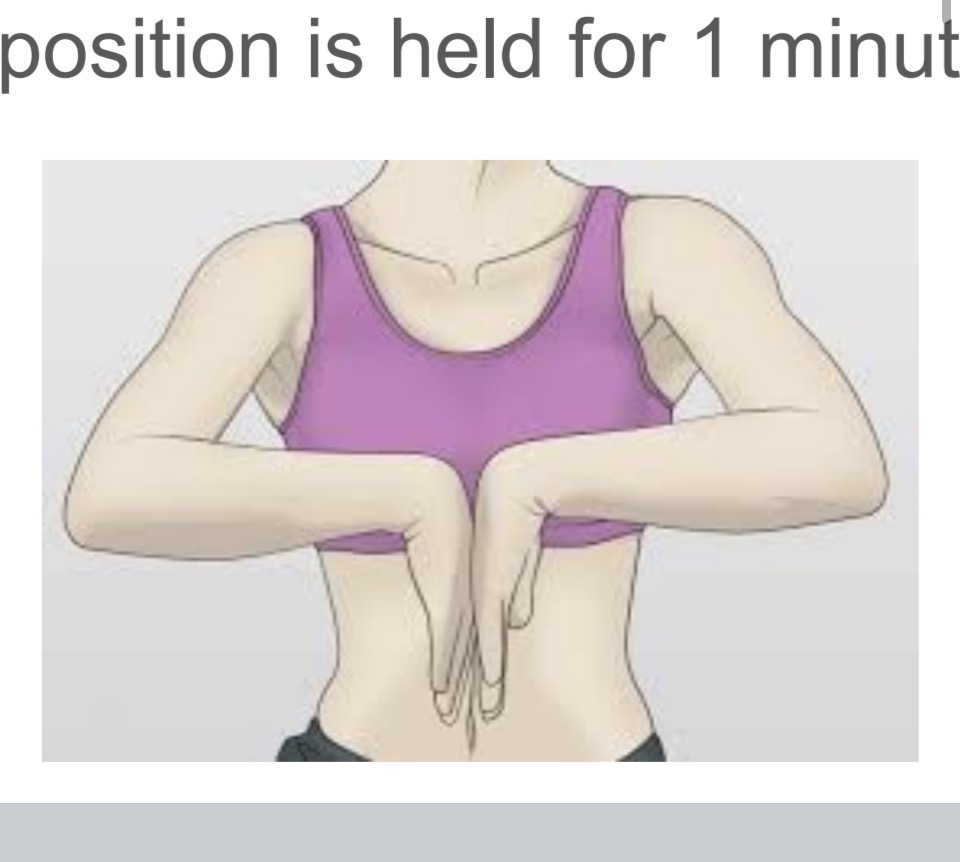 <p>A test where both wrists are flexed and pushed together for 1 minute; numbness or tingling indicates a positive test.</p>