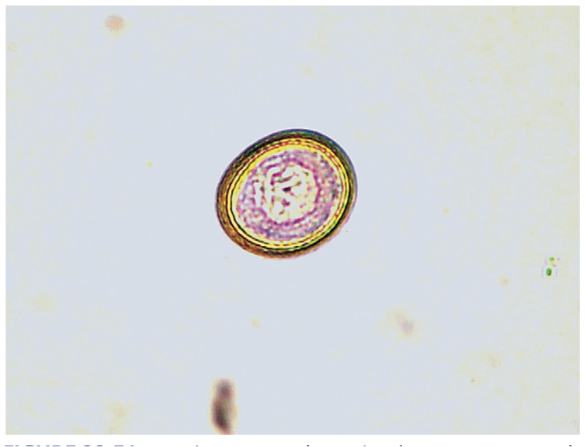 <p>A type of tapeworm.</p>