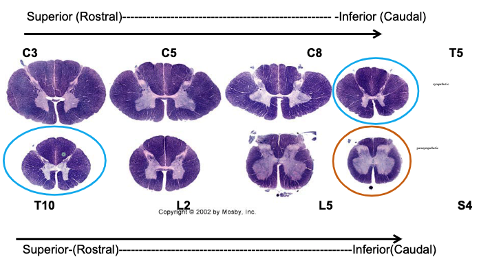 <p>Preganglionc sympathetic neurons for the autonomic NS are visible in T5 and T10. Which area are they located in?</p>
