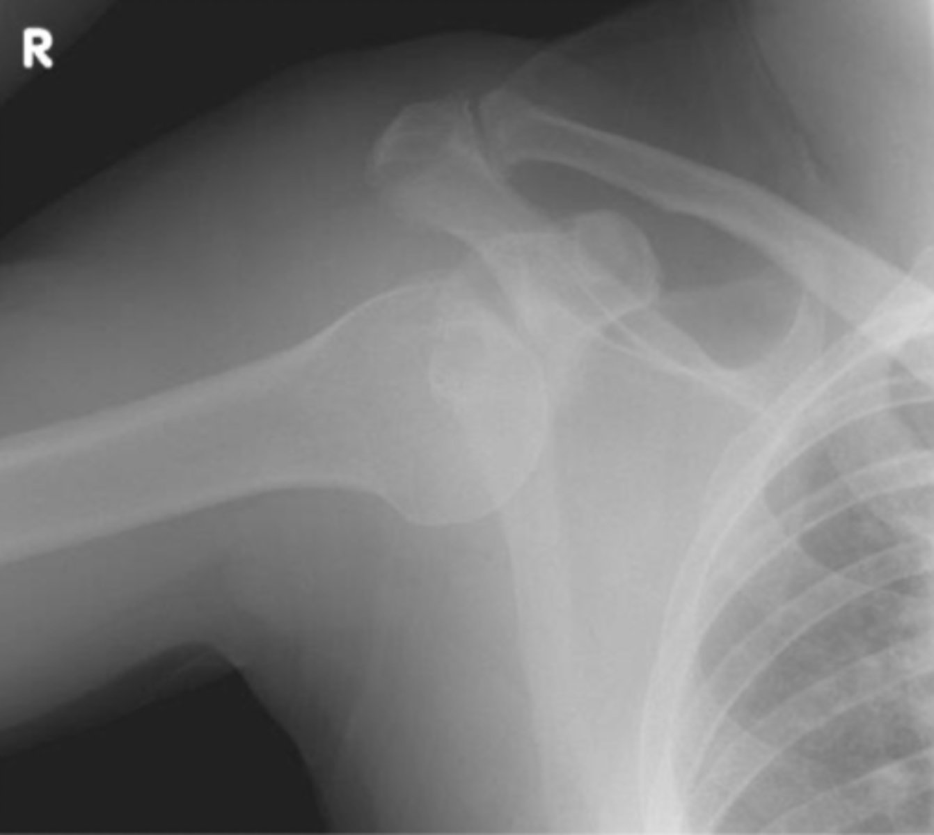 <p>What is the issue?</p>