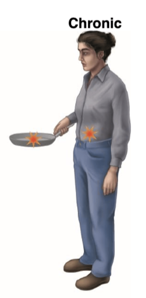 <p>individual who shelters the infectious</p><p>agent for a long period</p>