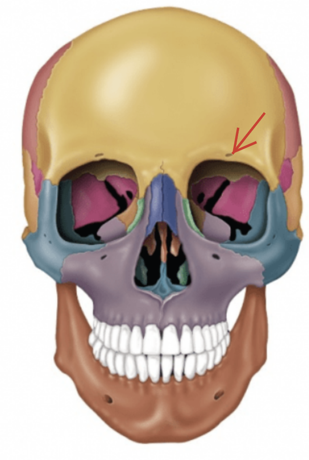 term image