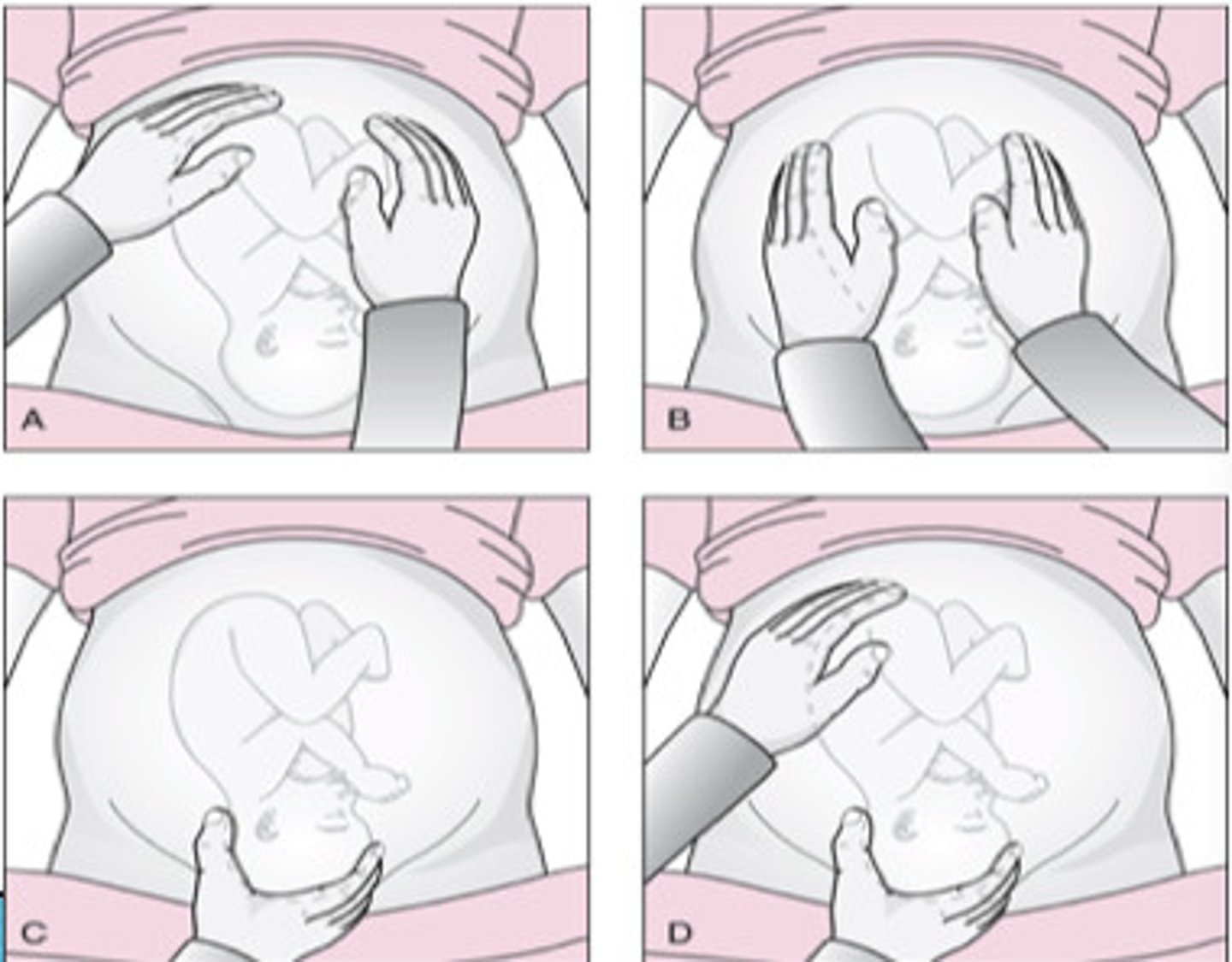 <p>Series of 4 types of abdominal palpitation for determining fetal position</p>