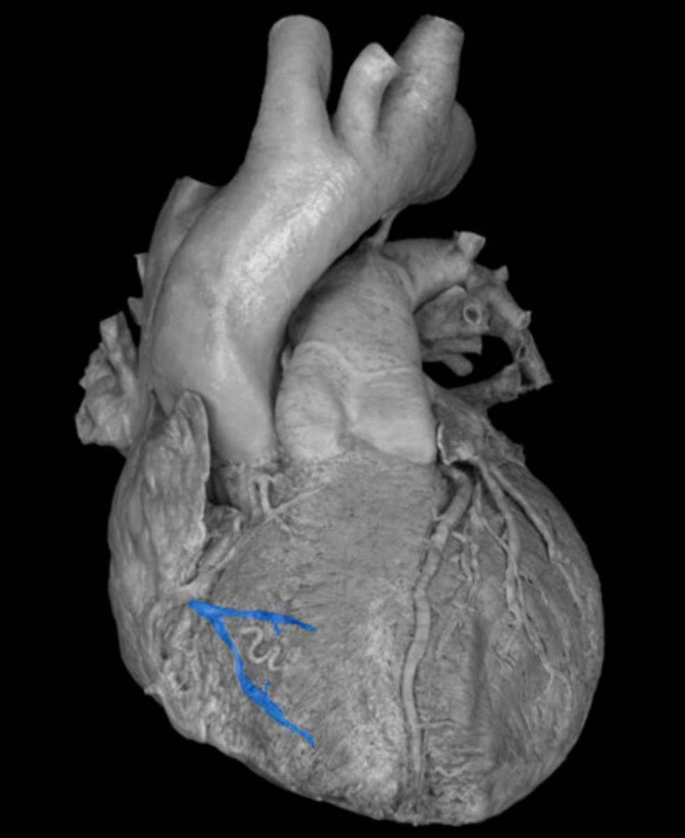 <p>top right side of T</p>