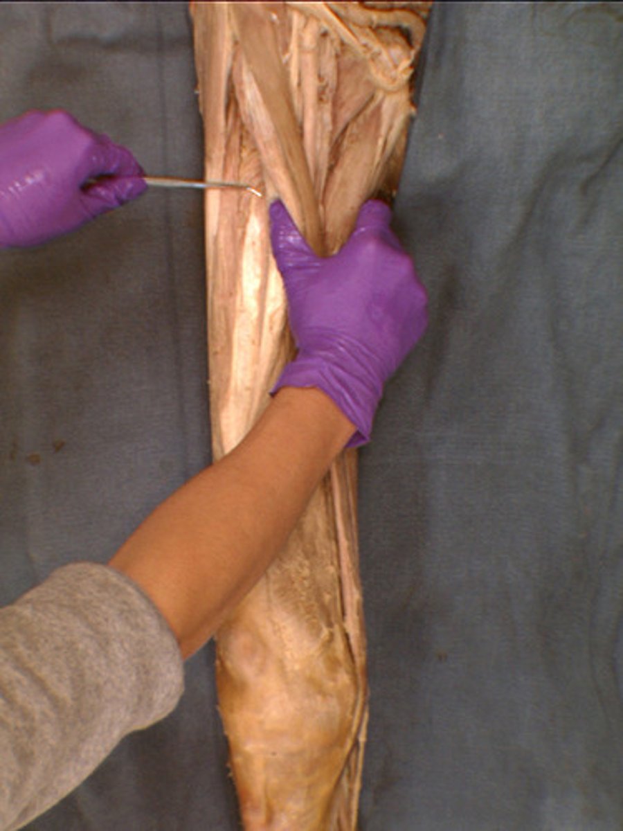 <p>Description: Underneath Rectus Femoris, between Vastus Lateralis and Vastus Mediali; , Extends knee</p>