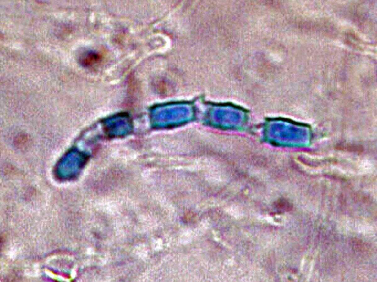 <p>Identify this fungi</p>