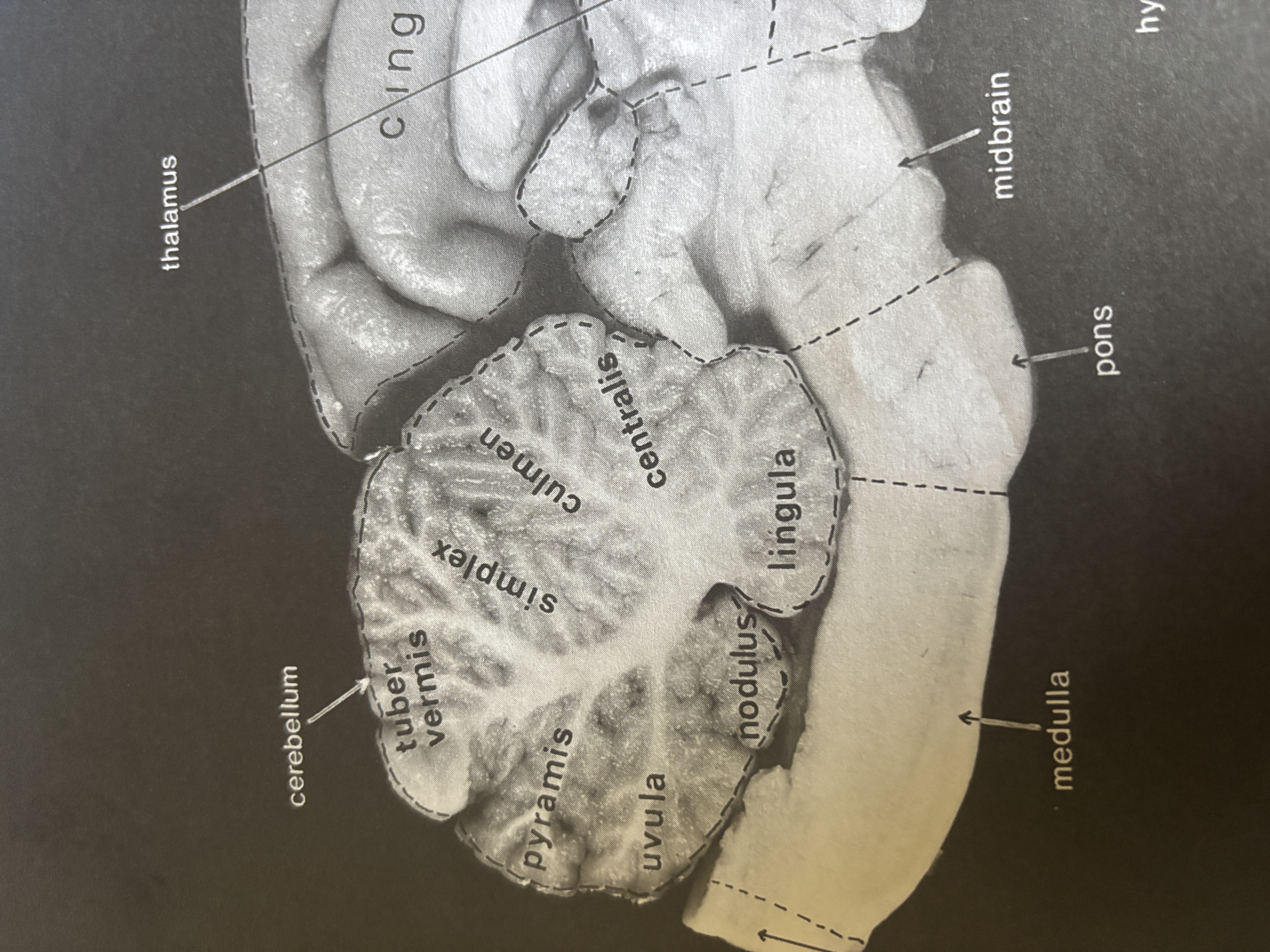 <p>Culmen</p>