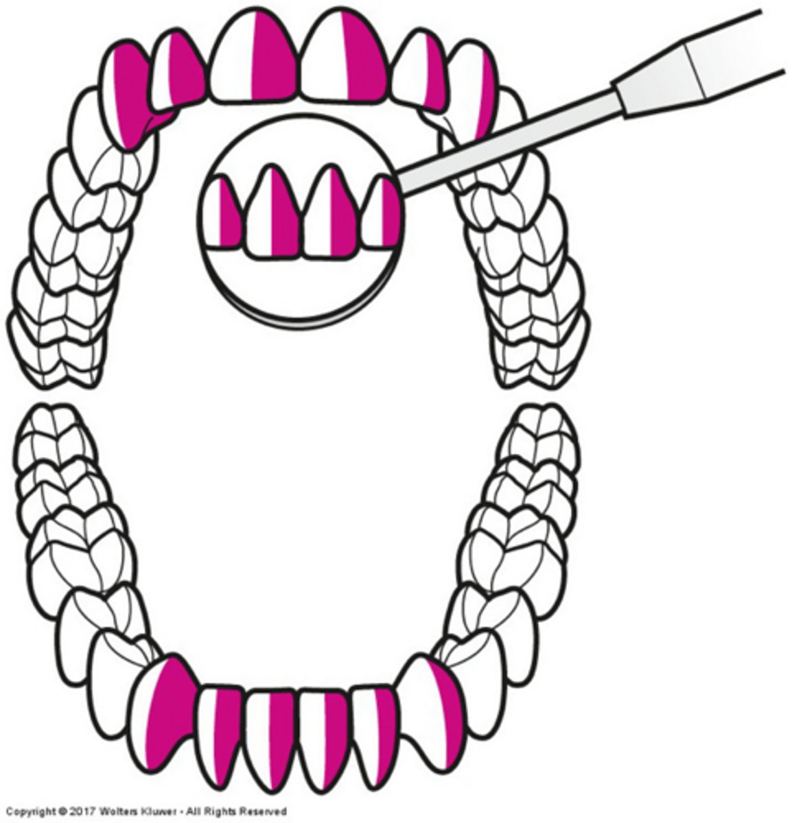 <p>11-1 o'clock</p>