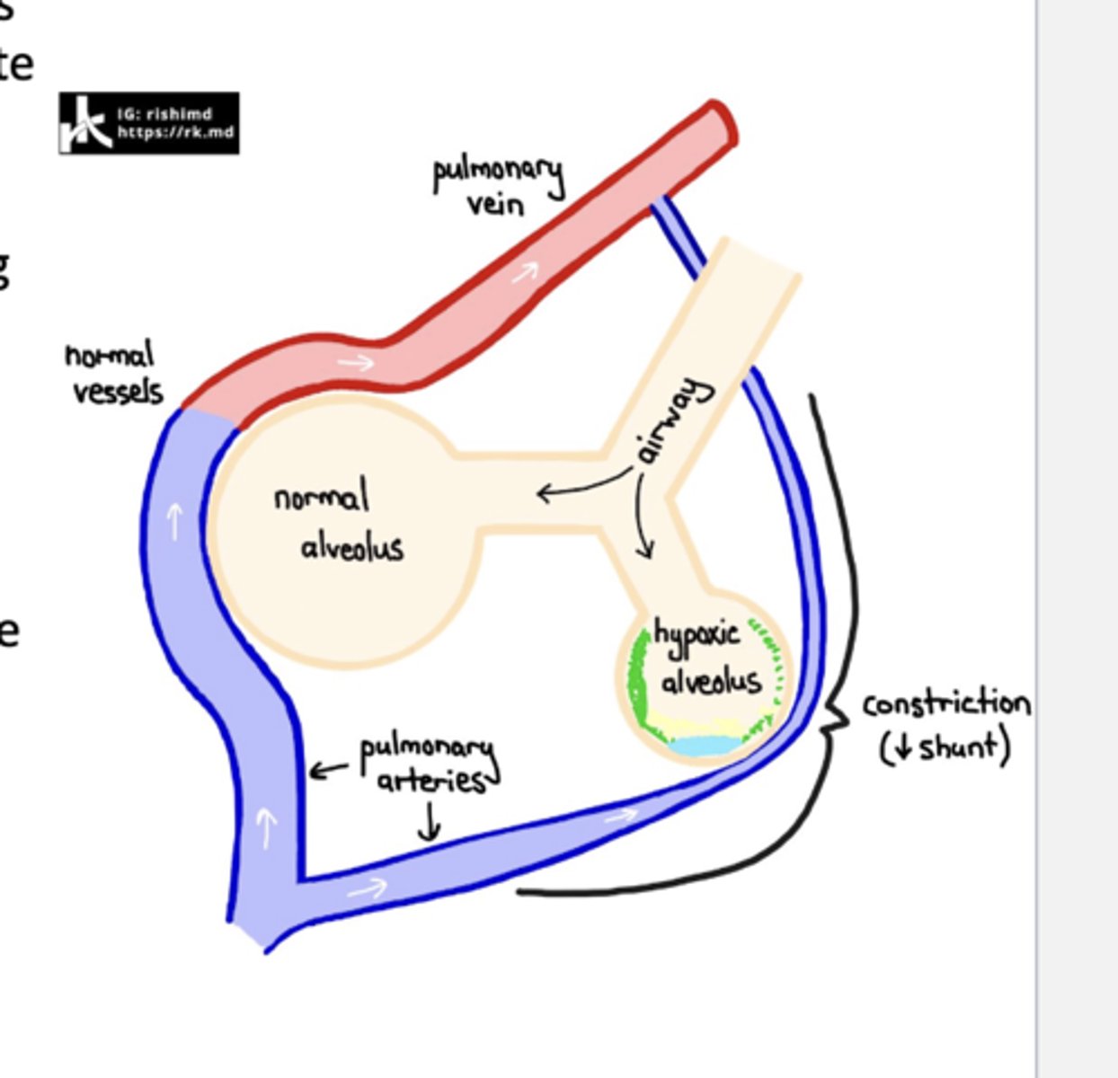 <p>False==&gt; pulmonary vessels contract when their surrounding alveoli are hypoxic (vasoconstriction in response to local hypoxia) </p><p>*the other pulmonary vessels dilate to compensate</p>
