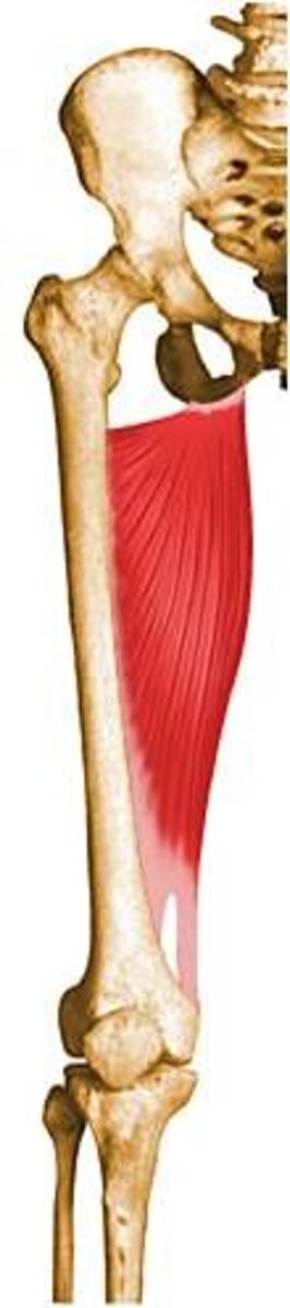 <p>Inferior ramus of the pubis, ramus of the ischium, and ischial tuberosity</p>