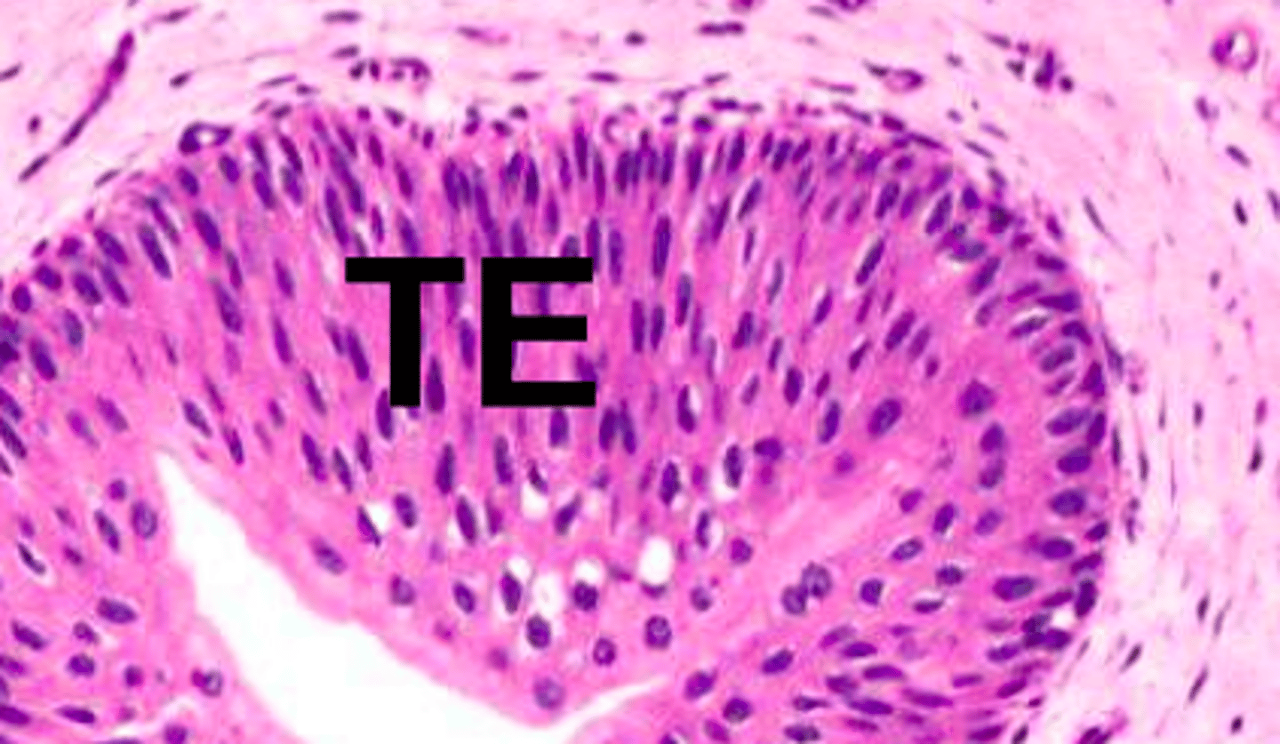 <p>- Distensible = tissues can expand when bladder fills with urine </p><p>- Protection = (multiple layers thick) from cytotoxic effects of urine </p>