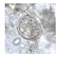 <p>What parasite egg is this?</p>