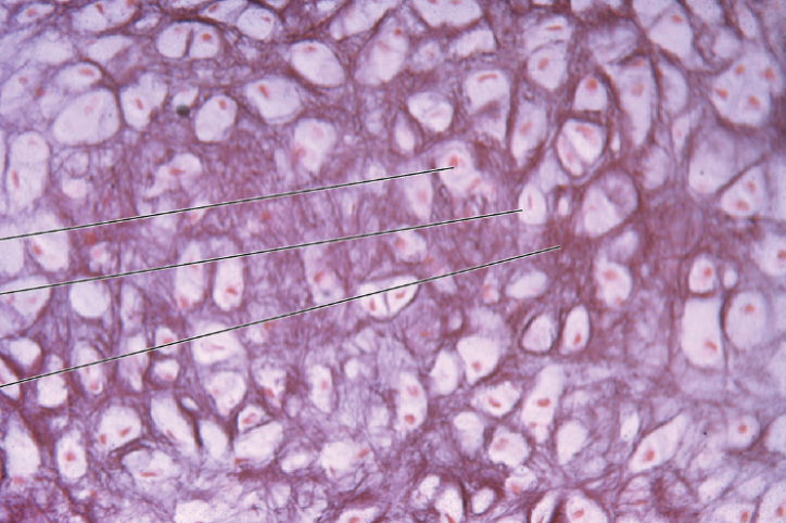 <p>What type of cartilage is this?</p>