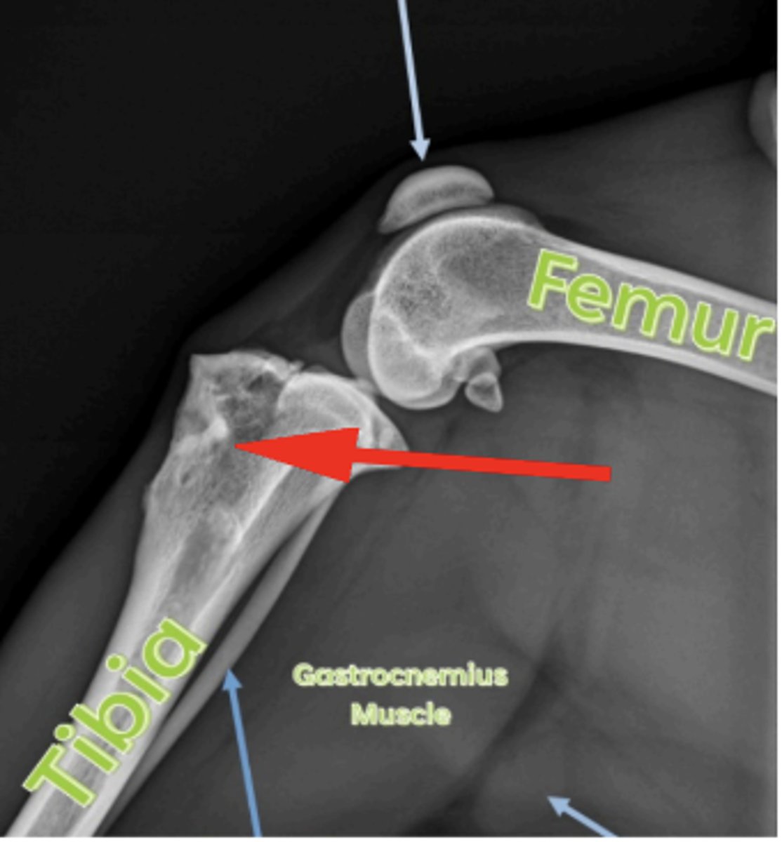 <p>What anatomical location is indicated by the arrow?</p>