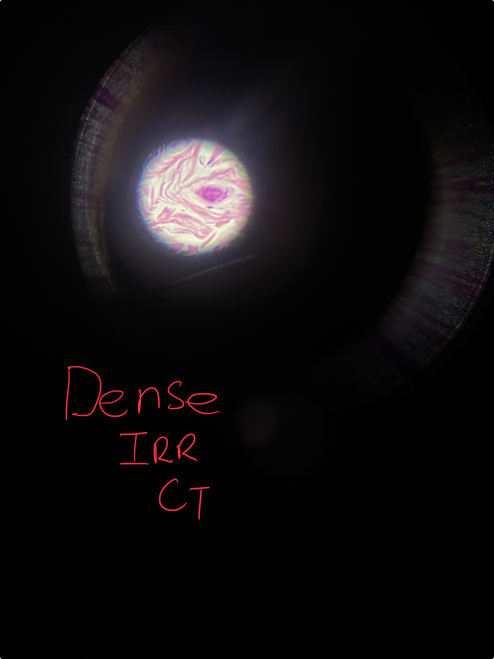 term image