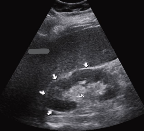 <p>Is this the right or left kidney? </p>