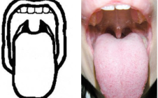 <p>classify</p>