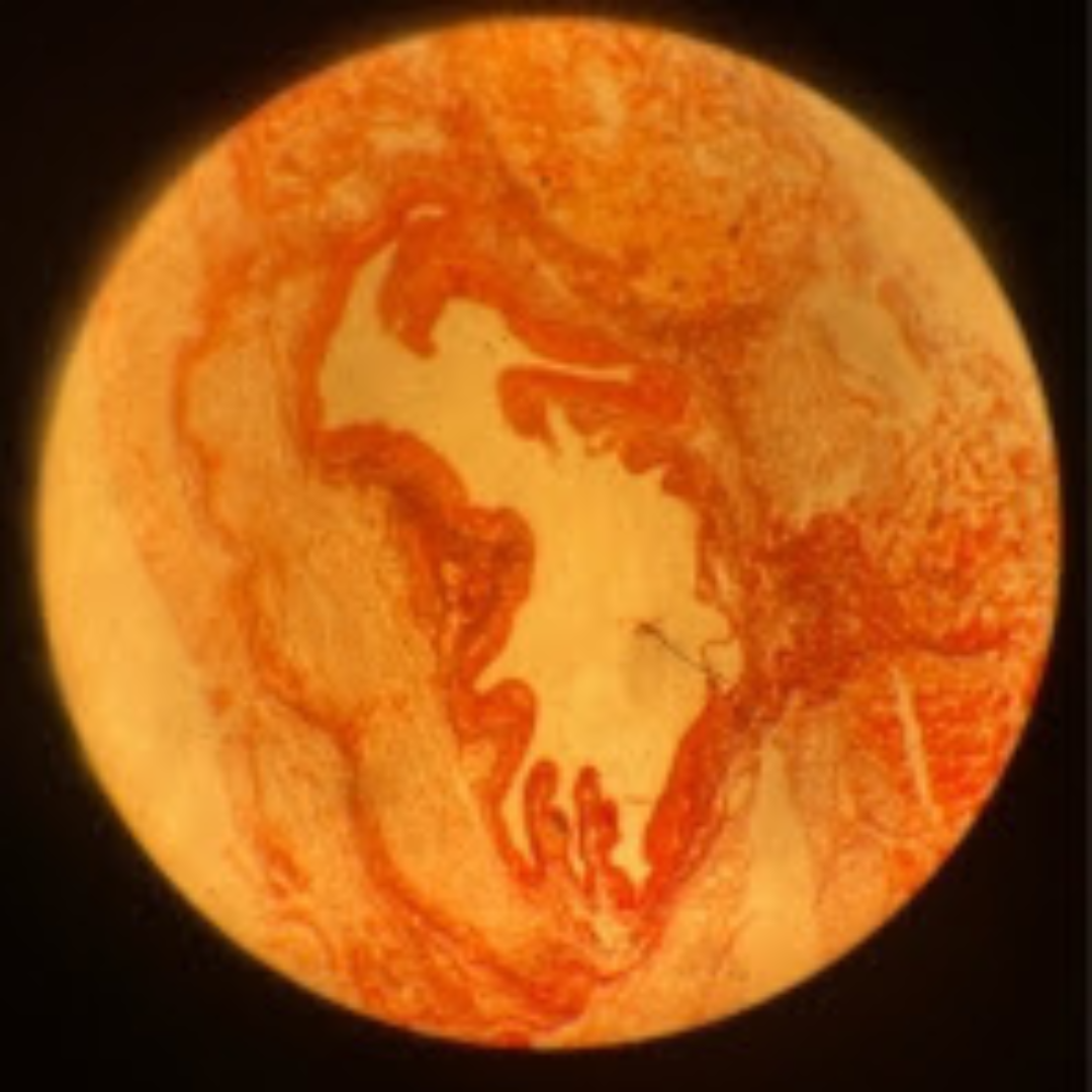 term image