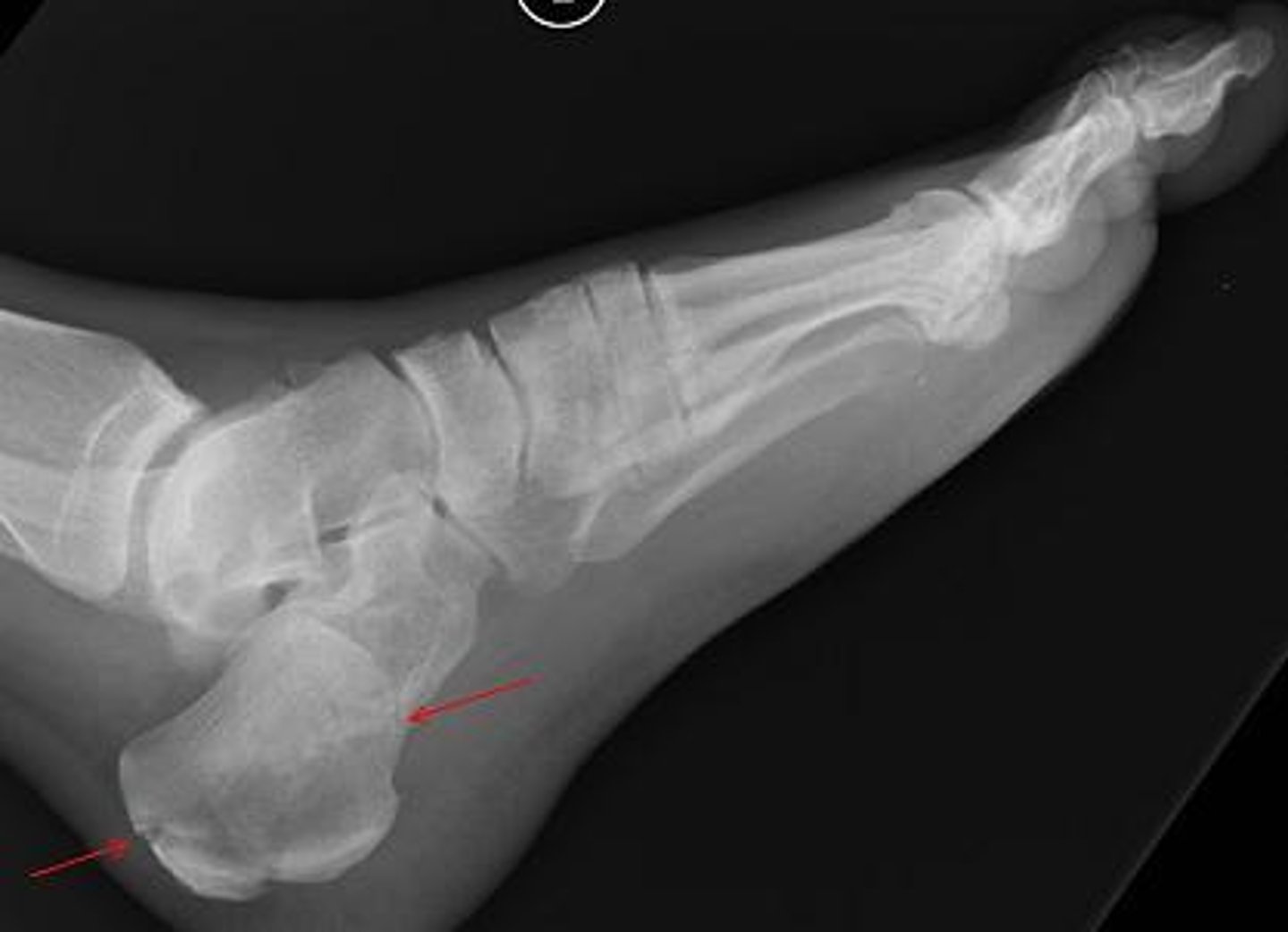 <p>ID bone at red arrows</p>