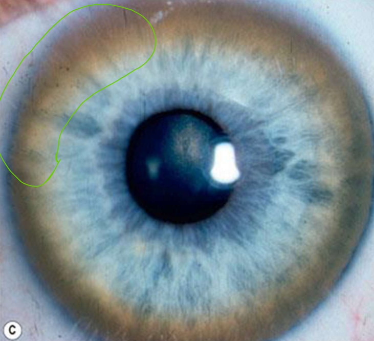 <p>What condition is this?</p>