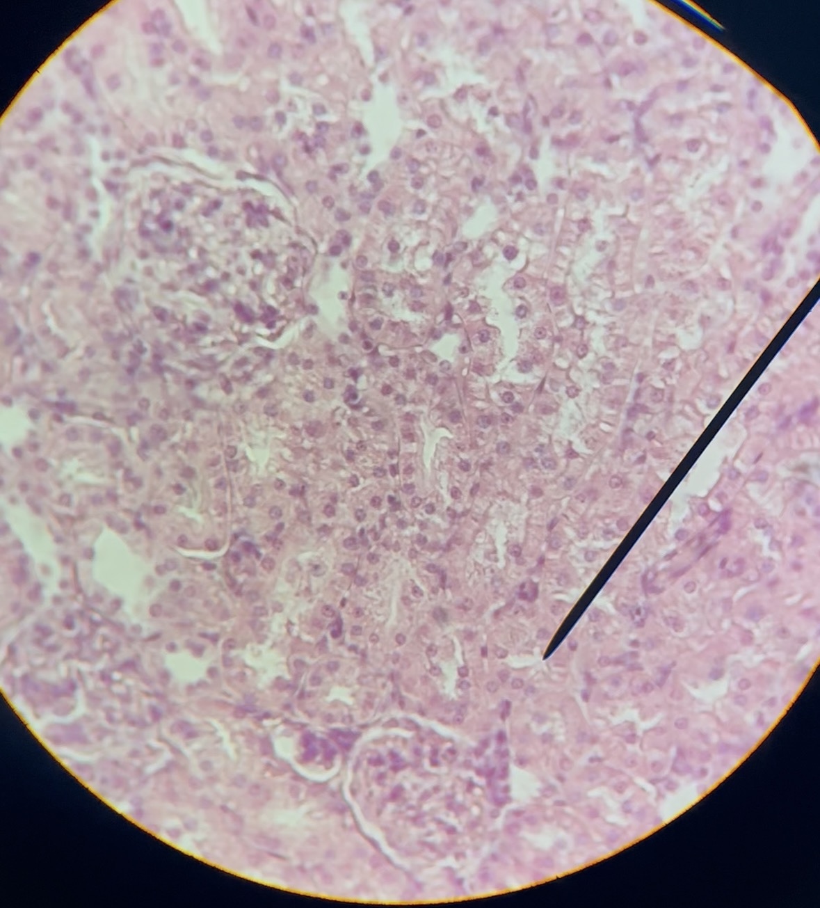 term image
