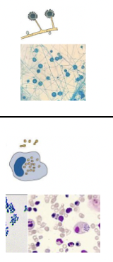<p>Mould - septate hyphae with small conidia and sunflower macroconidia</p><p>Yeast - small oval budding yeast cells in macrophages </p>