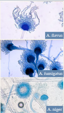✤ Opportunistic mold with a few hundred species.

✤ Approximately 20 species have been associated with clinical infections.

✤ Transmission of Aspergillus species is via fungal spores either as aerosols or contaminated products or biologics (Found in a manufacturing factory for injectable pain killers).