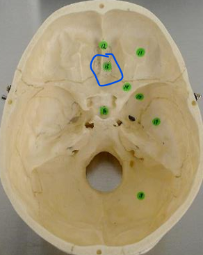 <p>#13 (internal skull)</p>