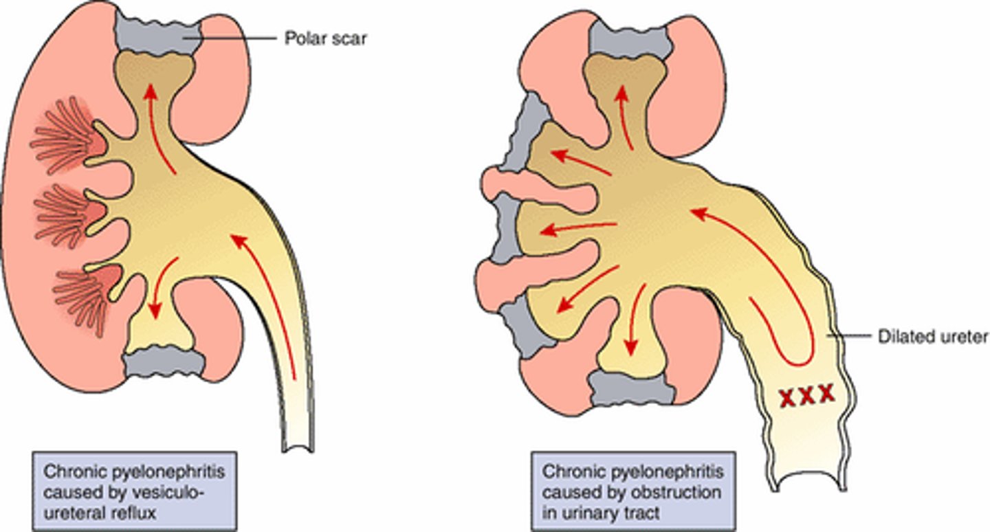 <p>Increase the patient's fluid intake to 3 liters daily.</p>