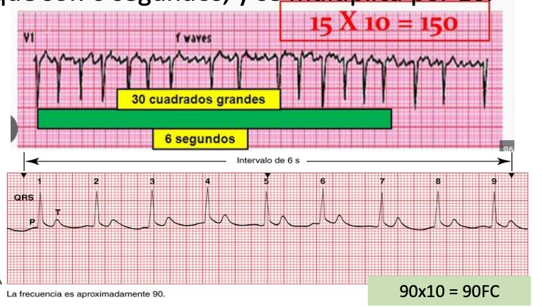 <p>Se cuentan el número de complejos QRS que hay en 30 cuadros grandes, que son 6 segundos, y se multiplica por 10.</p>