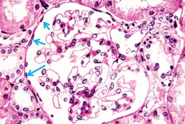 <p>1. renal corpuscles<br>2. alveoli of lungs<br>3. lining of heart, blood and lymphatic vessels and ventral body cavity (serosae)</p>