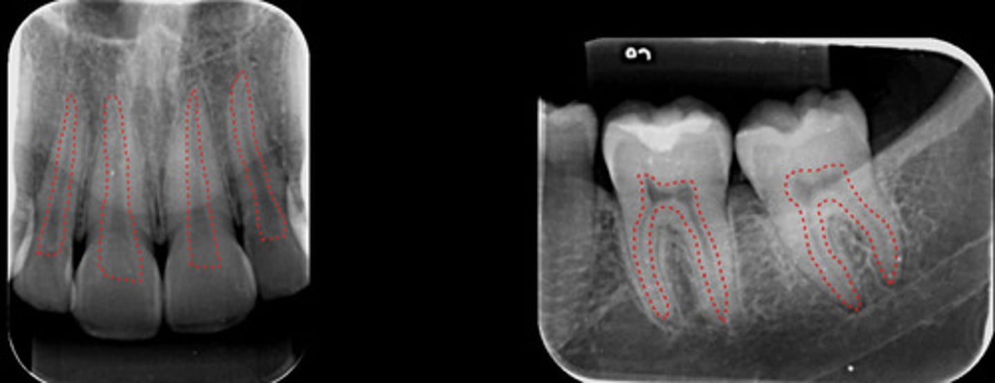 <p>What are the dotted lines representing?</p>
