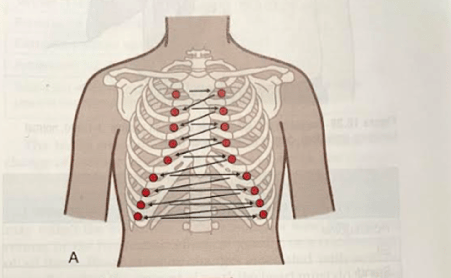 <p>Systematic approach, starting at the clavicle and progressing down through each intercostal space.<br>-Tap 3 consecutive blows before moving on and always compare side to side.</p>