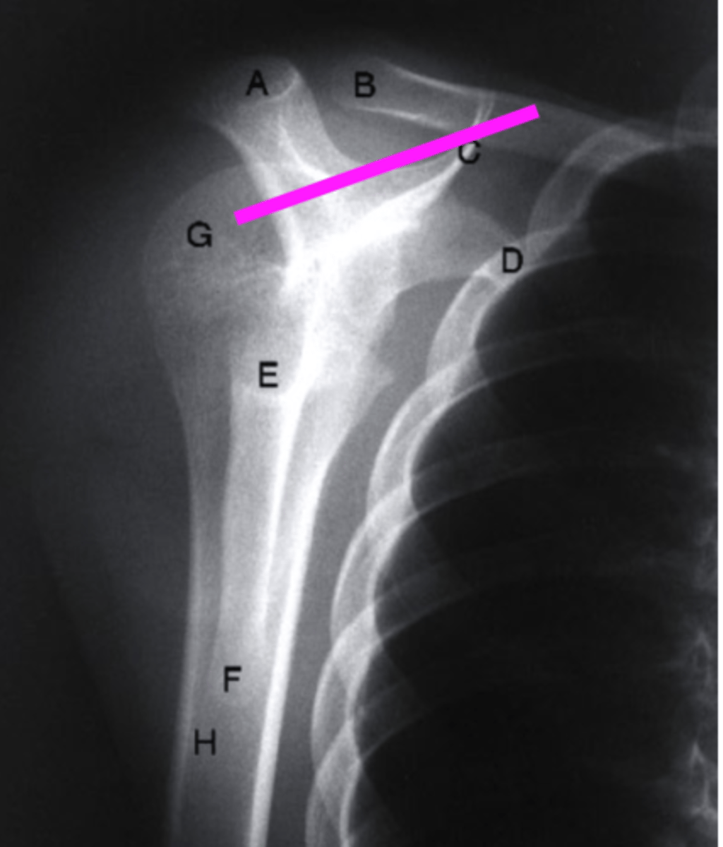 <p>what does the pink line point to?</p>