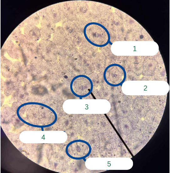 <p>What phase of mitosis is in cell 4 (JUST ONE CELL)?</p>