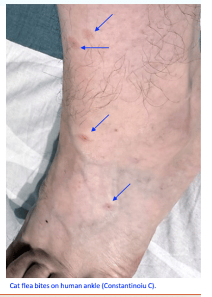 <p>Ctenocephalides spp. can bite humans, especially when:</p><p>• Pets are temporarily removed; </p><p>• Flea populations are large.</p>