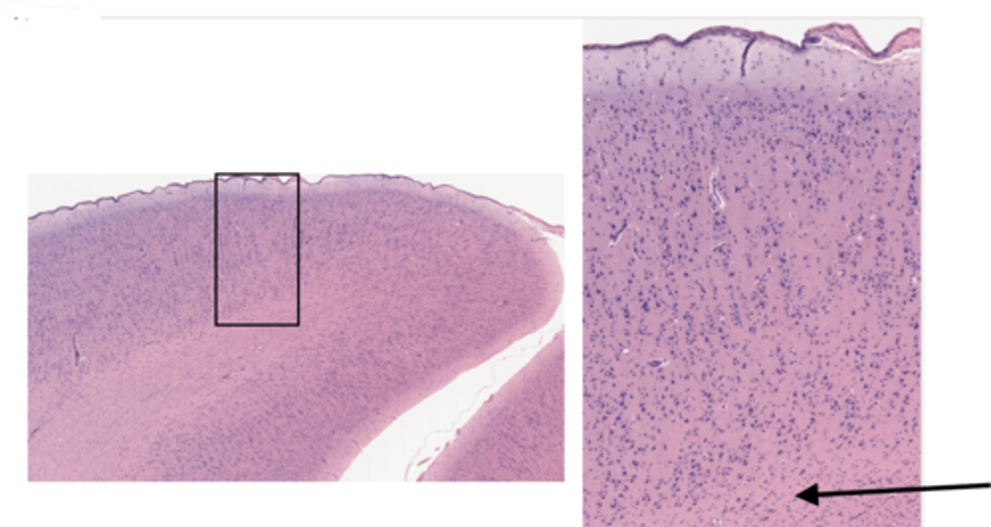 <p>Identify the layer of the cerebrum</p>