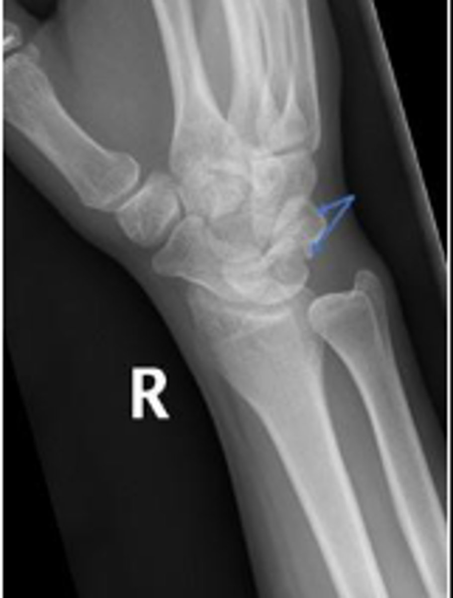 <p>What are the arrows pointing to?</p>