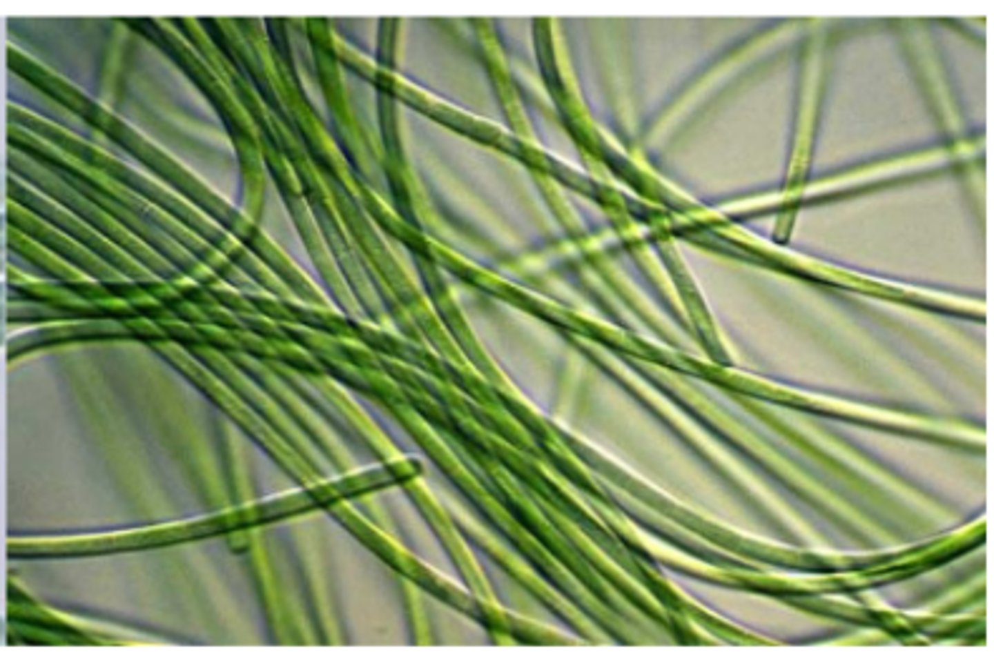 <p>What is the PHYLUM of the organism pictured?</p>