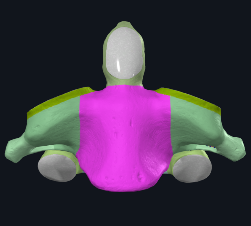 <p>name the bone and highlighted (pink)</p>