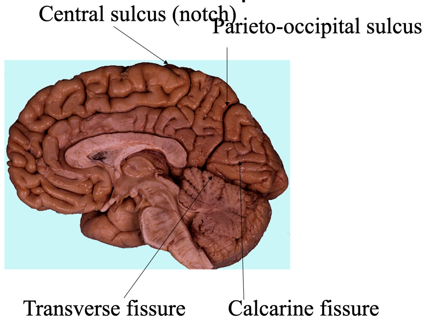 <ul><li><p>Parieto-occipital sulcus Separates parietal and occipital lobe</p></li><li><p>Calcarine fissure important for visual fields</p></li><li><p>The Cuneus is above and the Lingual gyrus below</p></li></ul><p></p>