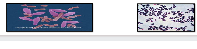 <ul><li><p>причинител на газовата гангрена</p></li><li><p>пръчковидни</p></li><li><p>в ранни стадии на растежа – Грам(+), в стари култури – Грам(-)</p></li><li><p>образуват капсула</p></li><li><p>неподвижен</p></li><li><p>образуват спори – субтерминално или парацентрално</p></li><li><p>строги анаероби</p></li><li><p>култивиране в кръвно-глюкозовия агар на Цайслер, лактозо-жлъчно-млечния агар на Уилис Хобс</p></li><li><p>кръгли колонии</p></li><li><p>характерна хемолиза с тясна вътрешна зона с пълна хемолиза (тета-токсин) и периферна – с непълна (алфа-токсин)</p></li></ul><p></p>