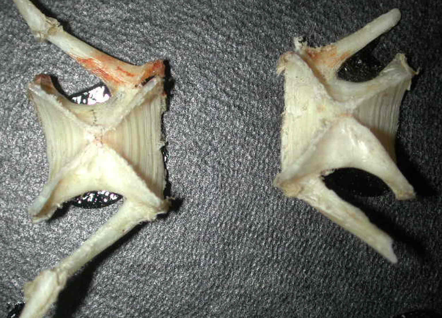 <p>What shape centrum is this?</p>