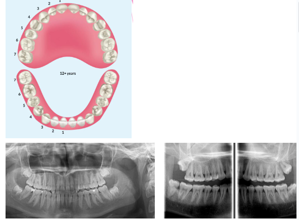 knowt flashcard image