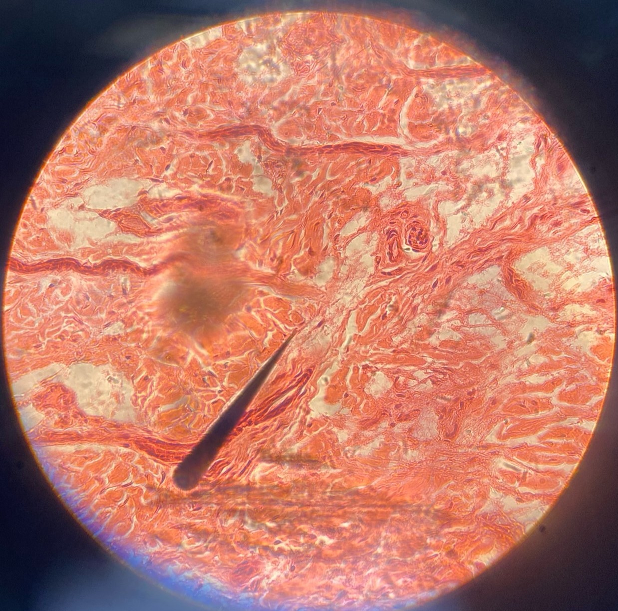 <p>stratified squamous epithelium</p>