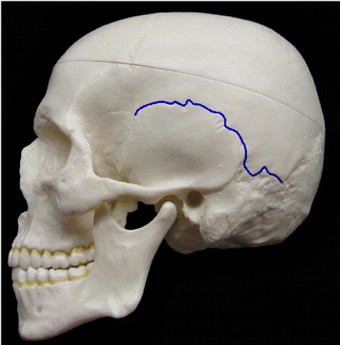 <p>Name the suture.<br><br>This suture connects?</p>