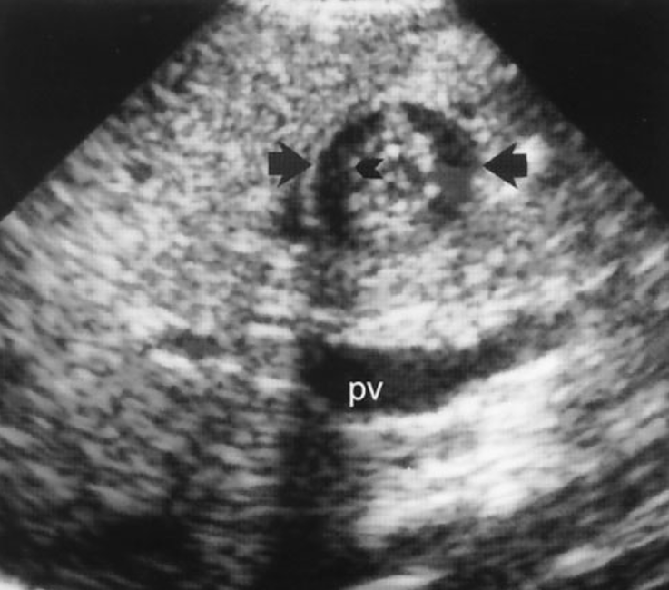 <p>what is shown?</p>